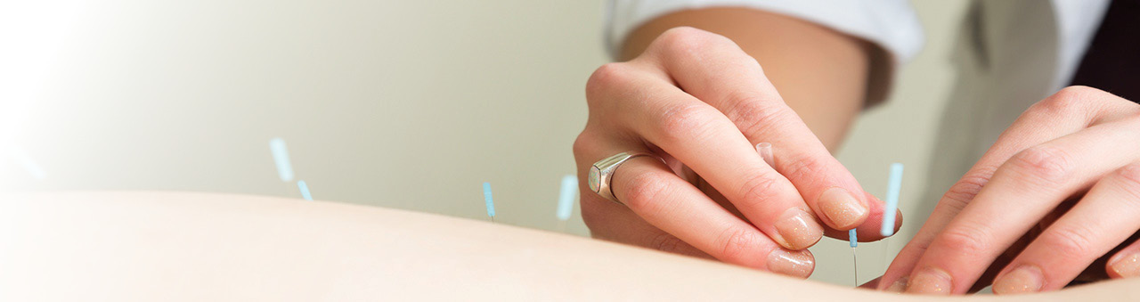Acupuncture
